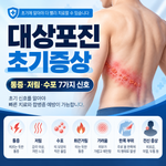 대상포진 초기증상