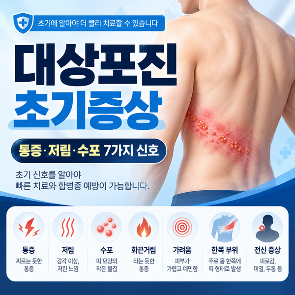 대상포진 초기증상