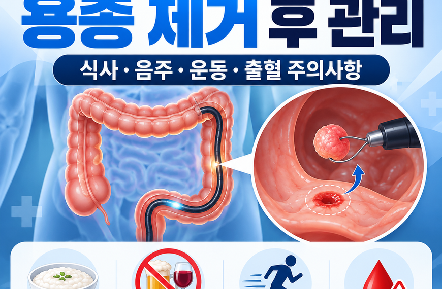 대장내시경 용종 제거 후 관리