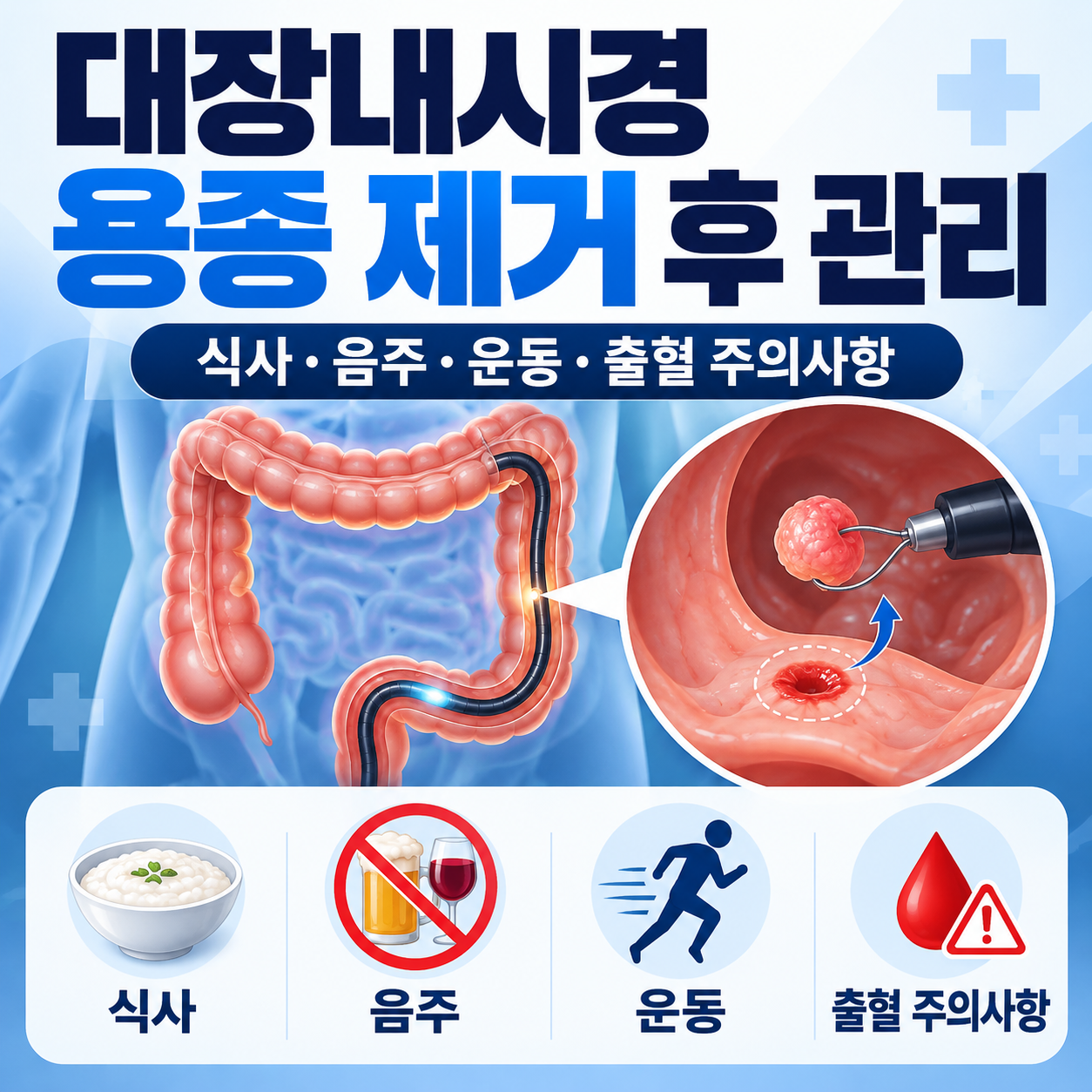 대장내시경 용종 제거 후 관리