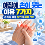 아침에 손이 붓는 이유