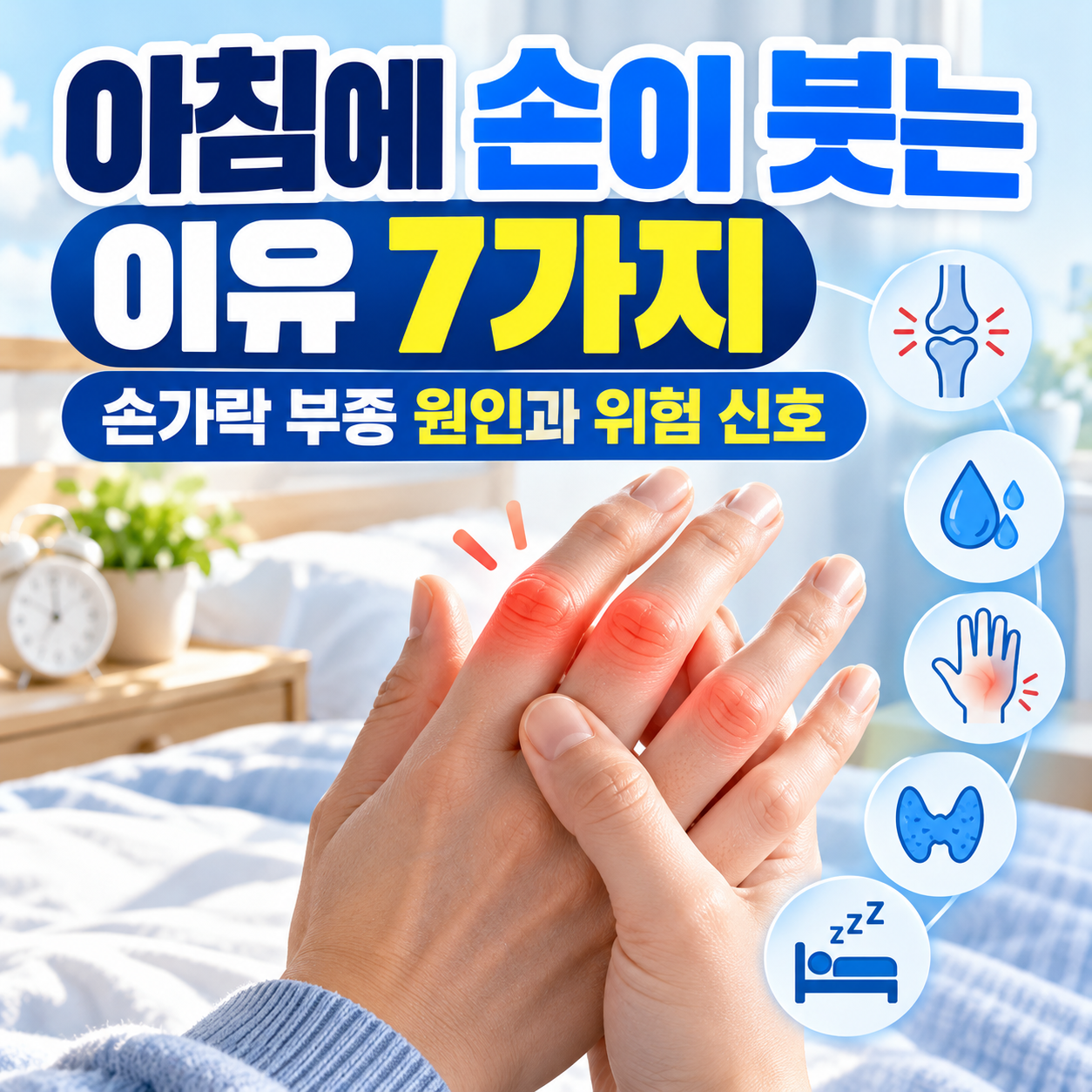아침에 손이 붓는 이유