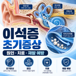 이석증 초기증상